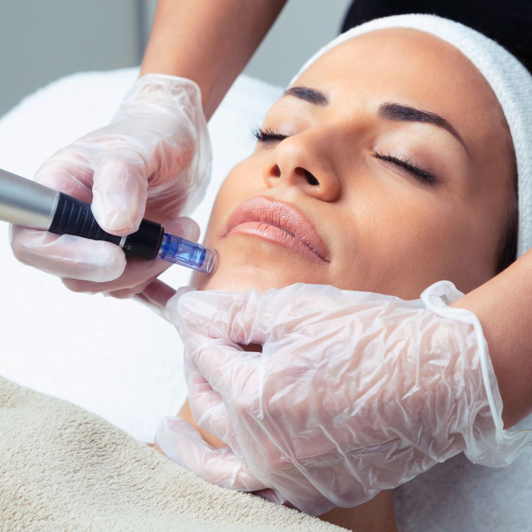 woman receiving microneedling treatment